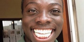 Instagram’da Sadece 32 Diş Sırıtarak Poz Veren Aşırı Mutlu ve Sevimli Fenomen Borzah Yankey