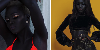 Ten Rengi İle İlgi Odağı Olan Karanlıklar Kraliçesi Nyakim Gatwech’in Azim Dolu Hikayesi