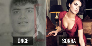 Önceki ve Sonraki Halleriyle Şaşkınlık Sınırını Arşa Çıkaran 18 Türk Ünlü