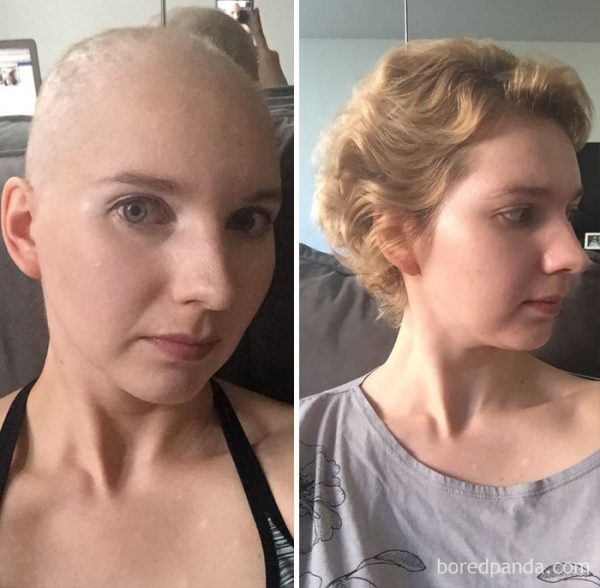 before-after-beating-cancer-14-5992bb405e365__700