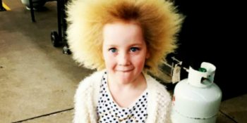 Dünyada 100 Kişide Görülen Düzensiz Saç Kökü Sendromuna Sahip 7 Yaşındaki Küçük Kız