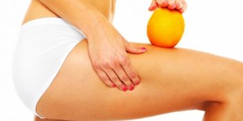 Kadınların Kabusu Selülit Oluşumunu Azaltmak İçin Yapmanız Gereken 11 Şey