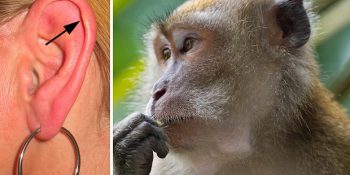 Ülkemizde Tartışmaları Devam Eden Evrimle Birlikte Körelmiş 16 Organ