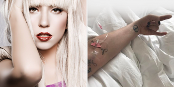 Lady Gaga’yı Hastanelik Eden Fibromiyalji Hastalığı Hakkında Bilmeniz Gereken 12 Şey