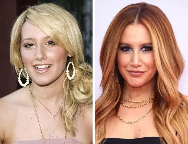 Ashley-Tisdale