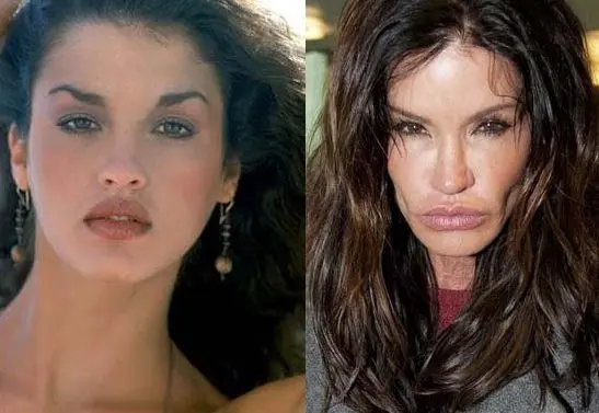 Janice-Dickinson