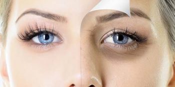 Yüz Yogasından Soğuk Komprese: Göz Altı Torbaları ve Morluklardan Kurtulmanıza Yardımcı Olacak 8 Yöntem