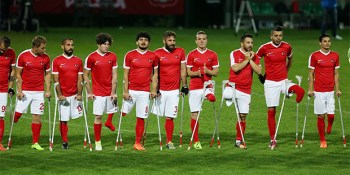 Milli Çoşkuyu Yeniden Yaşatan Ampute Futbol Takımımıza Sosyal Medyadan 13 Destek