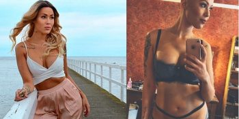 Saçkıran Hastalığıyla Barıştıktan Sonra Etkileyici Bir Modele Dönüşen Therese Hansson