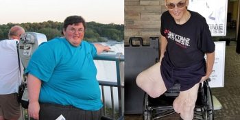 3 Ay İçinde Öleceğini Öğrenen Obez Adamın İnanılmaz Değişimi ve Hayat Hikayesi
