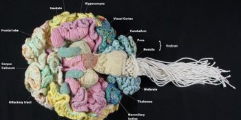 Beyin Hasarı Sonucu Şimşek Hızıyla Dahi Olan 5 İnsan Ve Arkasındaki Gerçek