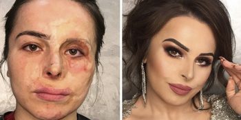 Yaralı Yüzleri Makyajla Adeta Bambaşka Birine Dönüştüren Güzellik Uzmanı Goar Avetisyan