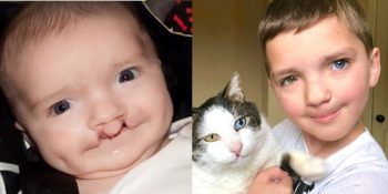 Görünüşü Yüzünden Arkadaşları Tarafından Dışlanan Ve Ardından Kedisi İle Dost Olan Madden