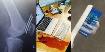 Şansın Ne Kadar Önemli Olduğunu Hatırlatan 19 Kalp Çarpıntılı Fotoğraf