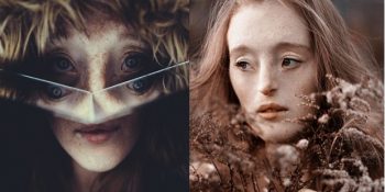 Ender Görülen Bir Yüz Kusuruyla Doğan Modelin Güzellik Standartlarını Yıkan Cesareti