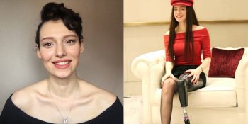 Bir Bacağını Kaybedip Dört Kez Kansere Yakalanan Demir Kadın Neslican Tay