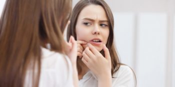 Sivilce Nasıl Geçer? 13 Maddede Sivilce Geçirme Yöntemleri