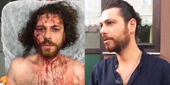 Kadıköy’de Bir Bara Gerçekleştirilen Silahlı Saldırı Ardından Darp Edilen Oyuncu Oral Özer