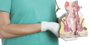 Basur (Hemoroid) Nasıl Geçer? Basura Ne İyi Gelir? 8 Maddede Basur Tedavisi