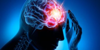 Sara Hastalığı Olarak Bilinen Epilepsi Hakkında Bilmeniz Gereken 7 Şey