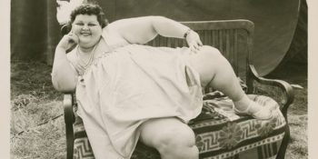 Hayatlarımızı Giderek Daha Fazla Tehdit Eden Obezite Hakkında Bilmeniz Gereken 8 Şey