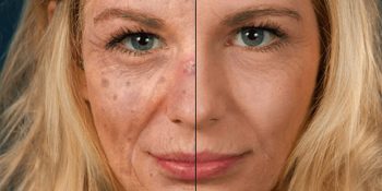 Güneşin Cildinize Ne Kadar Zarar Verebileceğini Gösteren Mobil Uygulama