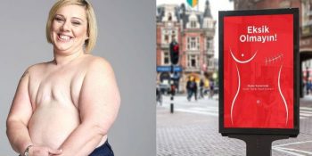 Meme Kanseri Hakkında Öğrenmeniz Gereken Bilgiler: Meme Kanseri Nedir ve Ne Değildir?