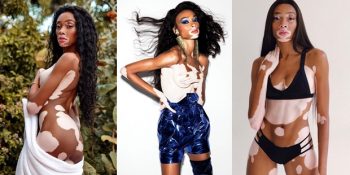 Moda Dünyasının Seyrini Değiştirip Kalıpları Yıkan Model Winnie Harlow