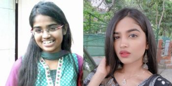 Umudunuzu Kaybetmemeniz Gerektiğini Değişimleriyle Kanıtlayan 17 Kişi