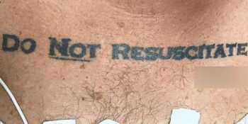 Ölmek Üzere Olan Adamın Doktorlara Dövmesiyle Verdiği Çarpıcı Mesaj