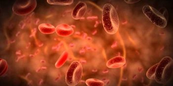 Akdeniz Anemisi Nedir? Akdeniz Anemisinin Belirtileri Neler?