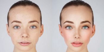 Fotoğraflarını Sosyal Medyada Yayınlanacak Hale Getirmeleri İstenen Gençlerin Değişimi