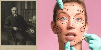 Modern Plastik Cerrahinin Kurucusu Dr. Thomas Addis Emmet