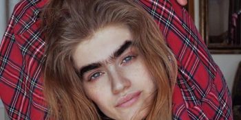 Geleneksel Güzellik Standartlarını Tamamen Yıkan 14 Model