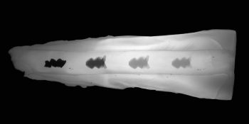 Dental Plakları MikroRobot Ordularıyla Temizlemek Mümkün