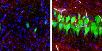 Bilim Adamları Ölü Domuzların Beynindeki Bazı Hücreleri Canlandırmayı Başardı