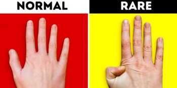 Yaparken İnsanı Şekilden Şekile Sokan 9 Güzide Hareket