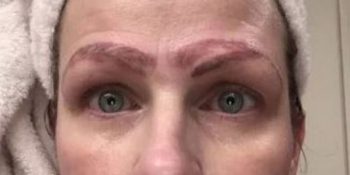 Kaşlarına Yaptırdığı Microblading Sonrası Dört Kaşla Kalan Kadın