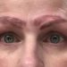 Kaşlarına Yaptırdığı Microblading Sonrası Dört Kaşla Kalan Kadın