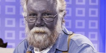 Dünyada En Nadir Görülen 15 Hastalık