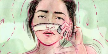 Vücuttaki Hayali Kusurları Takıntı Haline Getirme: Quasimodo Sendromu