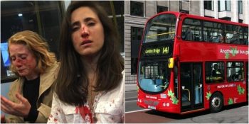 Önce Öpüşmeye Zorlanan Ardından Öldüresiye Dövülen Lezbiyen Çift