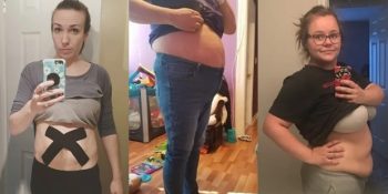 Doğumdan Hemen Sonra Vücutlarının Fotoğrafını Paylaşan 29 Cesur Anne