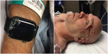 Akıllı Saat Sayesinde Mucizevi Bir Şekilde Hayatı Kurtulan Adam