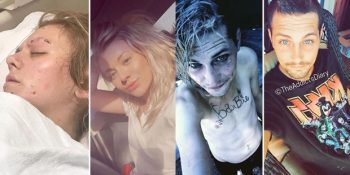 İnsanların Uyuşturucuyu Bıraktıktan Sonraki Değişimlerini Gösteren 17 Fotoğraf