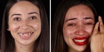 Dünyayı Dolaşarak Yoksullara Gülümsemelerini Geri Veren Diş Hekimi