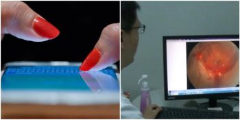 Telefonunu Bilinçsizce Kullandığı İçin Görme Kaybı Yaşayan Çinli Kadın