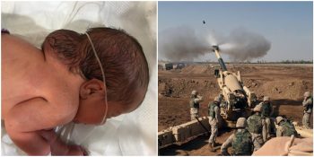 ABD’nin Kullandığı Kimyasal Silahlar Irak’ta Doğum Kusurlarına Neden Oluyor