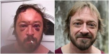 Sarhoşken Çektiği Fotoğraf Sayesinde Alkolü Bırakan Gene Davis