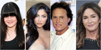 Her Şeyi Zamana Bırakmalı: 10 Yıl Önceki Hallerini Tanımakta Zorlanacağınız 20 Ünlü